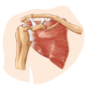 How to Protect Your Rotator Cuff from Repetitive Use Injuries